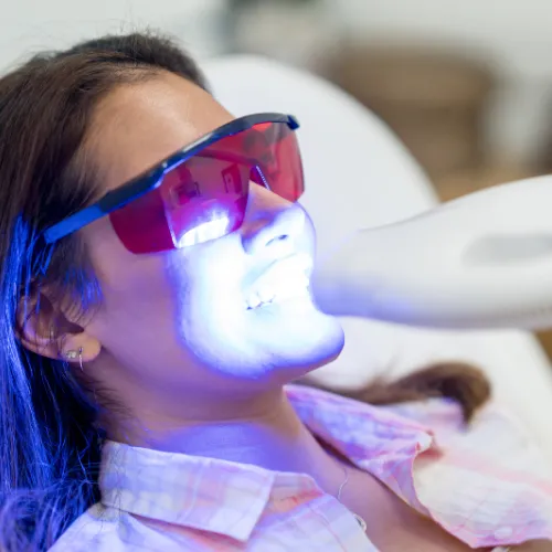 Professional teeth whitening