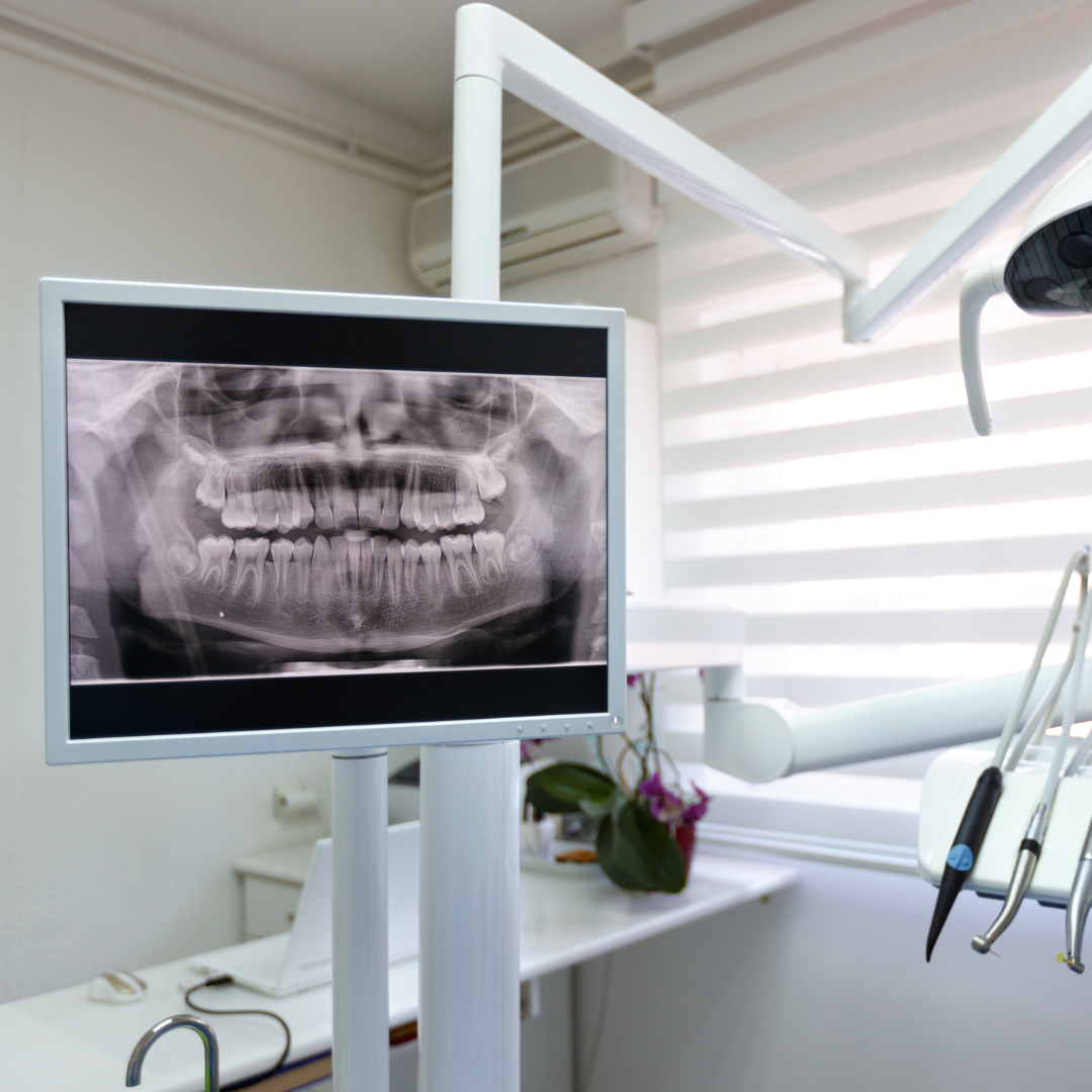 Digital X-Rays